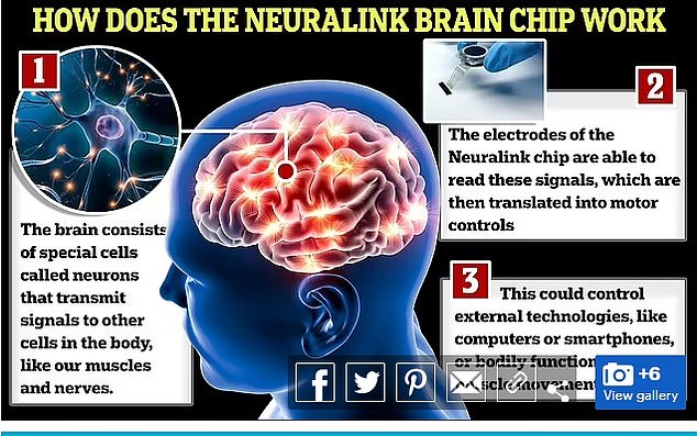 Neuralink-Gehirnchips übertragen Signale an die Nerven des Körpers, die in motorische Steuerungen umgesetzt werden