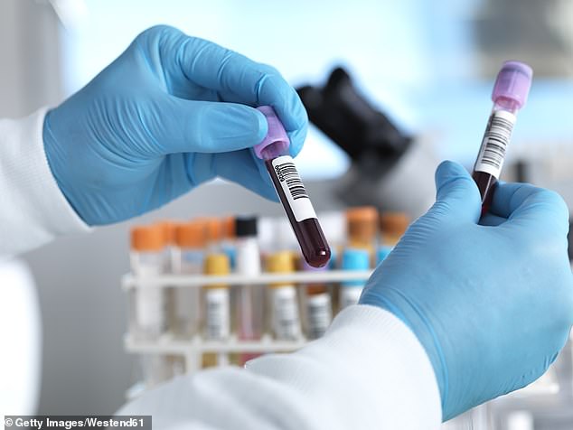 Derzeit werden Gewebebiopsien verwendet, um eine Diagnose zu bestätigen, und Proben können dann für Genomtests verschickt werden, was zu einer Wartezeit von bis zu einem Monat führen kann.  Im Rahmen der neuen NHS-Studie werden die Tests in einem Labor des Royal Marsden Hospital in Sutton, Surrey, analysiert.  Die Ergebnisse werden etwa zwei Wochen später zurückgegeben