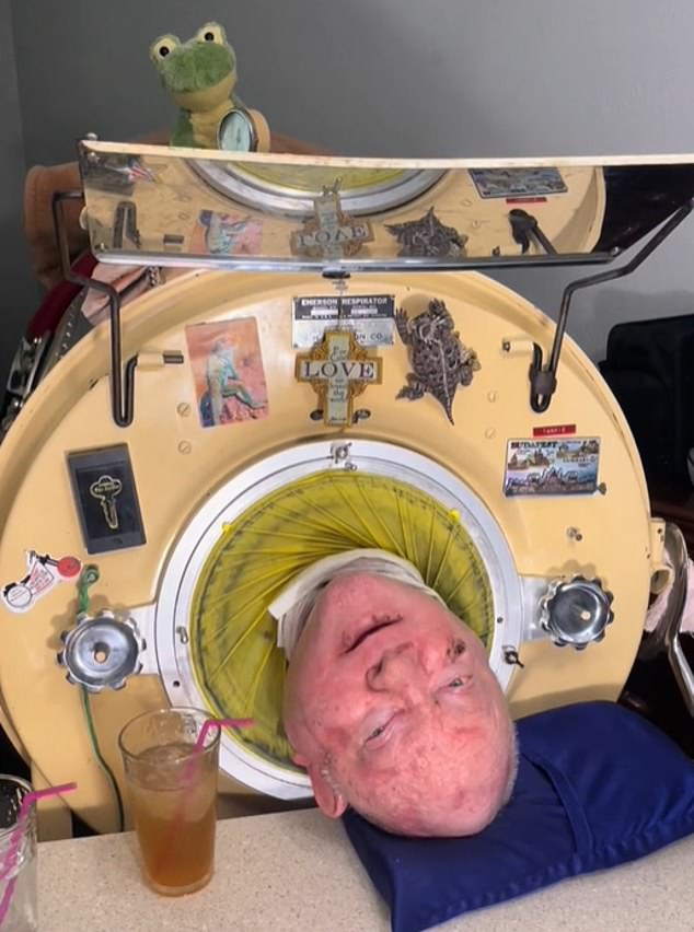 For more than 70 years, Paul Alexander ¿ who died aged 78 this week ¿ was kept alive with the help of 'iron lungs'. The spooky contraption, created in the 1920s, allowed him to breathe after he was completely paralysed as a child by polio. It saw him lay flat on his back, with his head resting on a pillow and body encased in the metal cylinder from the neck down