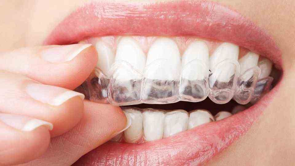 Zähne bleachen mit Bleichmittel