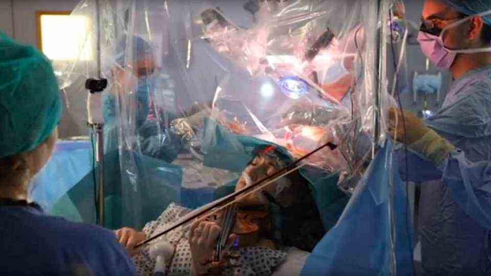 A patient plays the violin while surgeons remove a tumor from her brain.