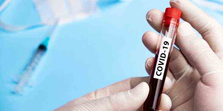 A person holds a blood test that says "COVID-19" in the hands.