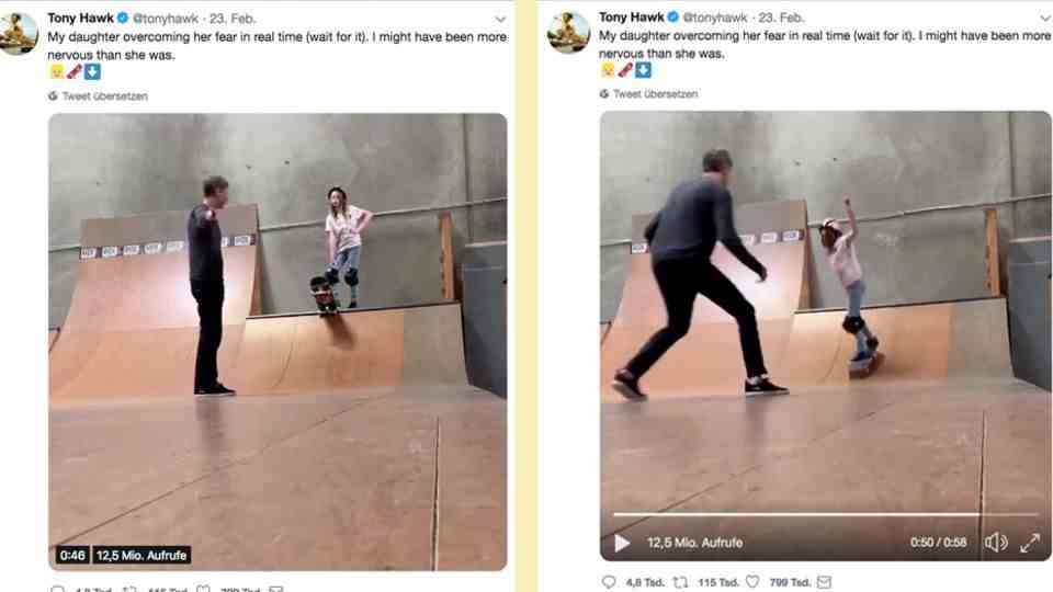 broken thigh: "Yesterday was shit": Skateboard legend Tony Hawk is in the hospital after an accident