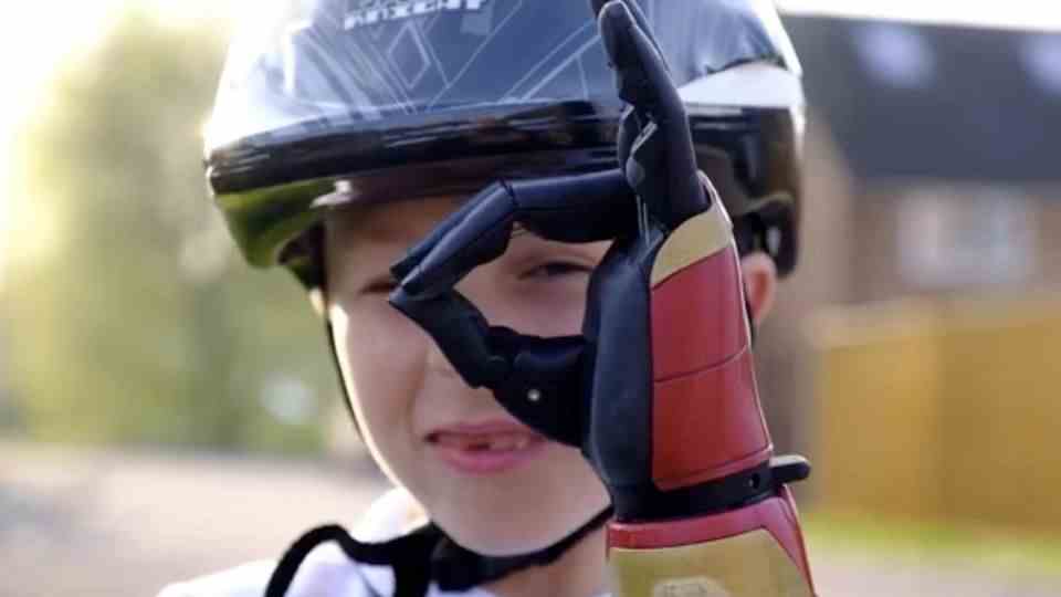 Boy with Iron-Man prosthesis for his left hand smiles