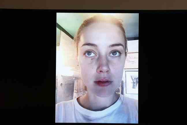 A photo of Amber Heard shown to the jury during the lawsuit filed by Johnny Depp.