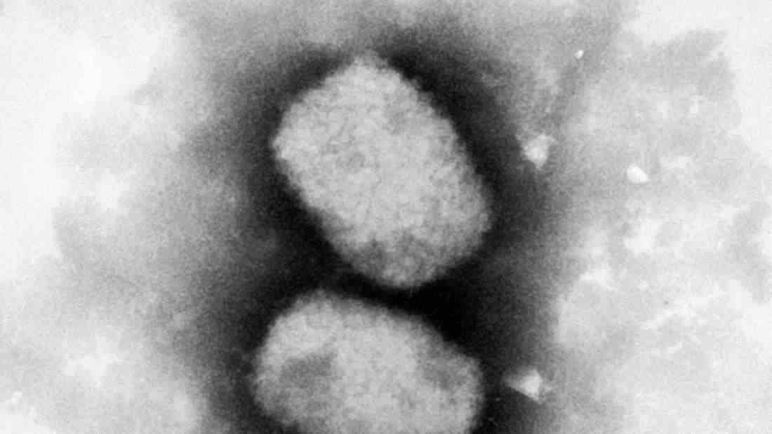 Diese vom Robert Koch-Institut (RKI) zur Verfügung gestellte elektronenmikroskopische Aufnahme zeigt das Affenpockenvirus. In Großbritannien sind sieben Fälle des Virus bekannt. (Archivbild)