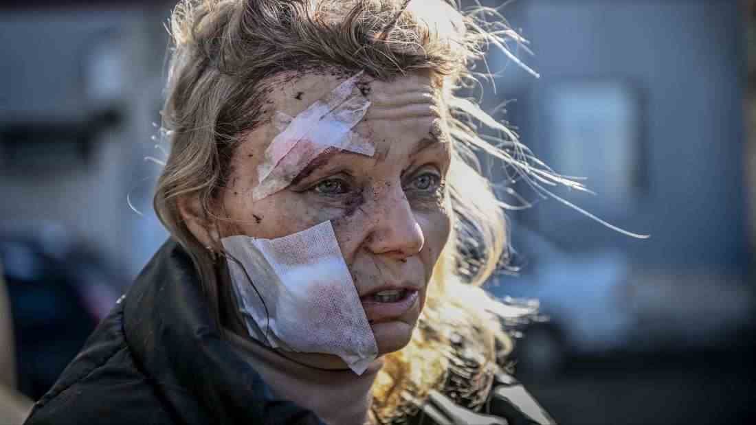 Am 24. Februar beginnt Russland mit dem Angriffskrieg auf die Ukraine. Die Stadt Tschuhujiw wird bereits am ersten Tag des Krieges bombardiert. Helena, eine 53 Jahre alte Lehrerin, steht dort vor einem Krankenhaus.