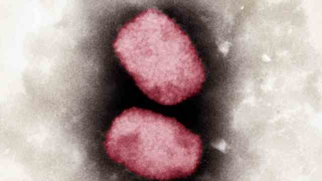 Virology: Colorized electron micrograph of monkeypox virus.