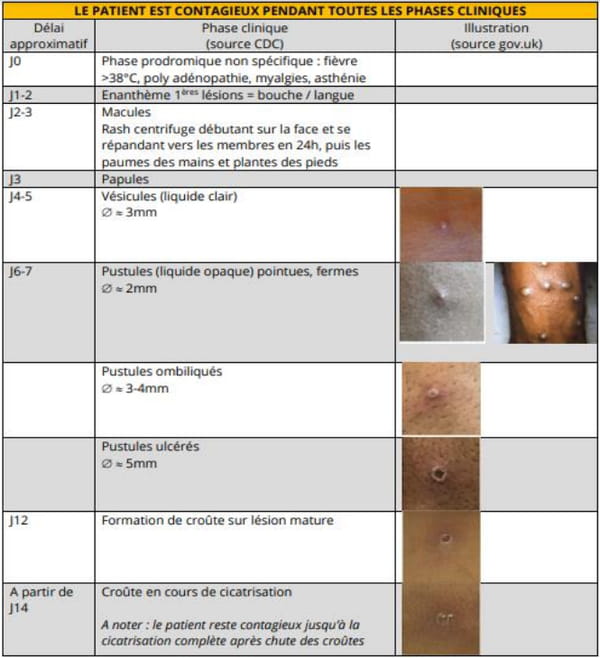 Image des différentes phases cliniques de la variole du singe