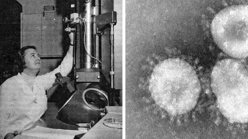 June Almeida knew how to get the most out of the electron microscopes-