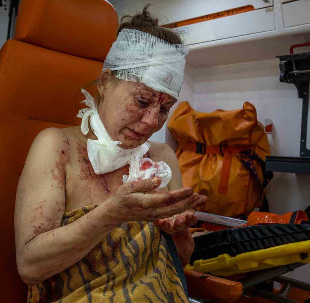 An injured woman looks at her wounds in an ambulance after a strike hit a residential area, in Kramatorsk, Donetsk region, eastern Ukraine, Thursday, July 7, 2022. (AP Photo/Nariman El-Mofty)