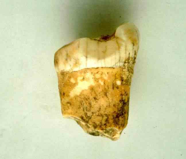 A Neanderthal molar found at the Gabasa site. 