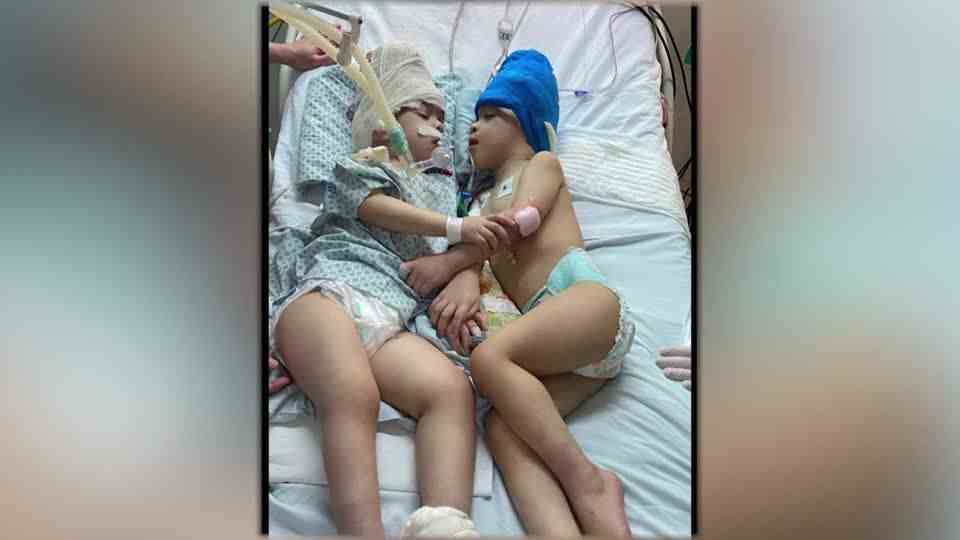 Sisters grown together: Conjoined twin opens up about his relationship with the three: "we are not intimate"