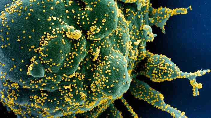 Pandemic: Corona viruses colored yellow infect a human cell.