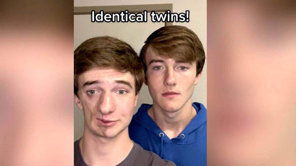 TikTok Twins Explain Parry-Romberg Syndrome (Viral Video)