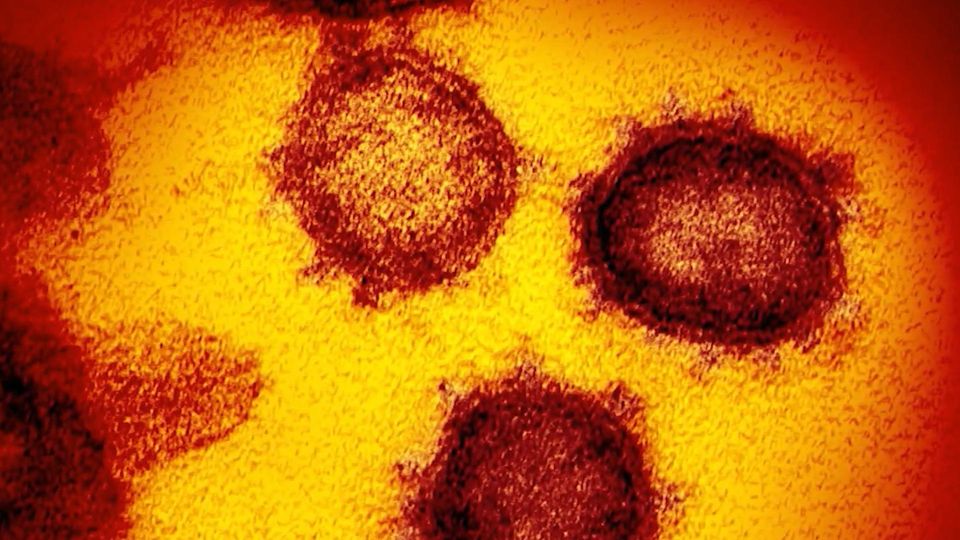 New variant "Eris": What you need to know about the coronavirus now
