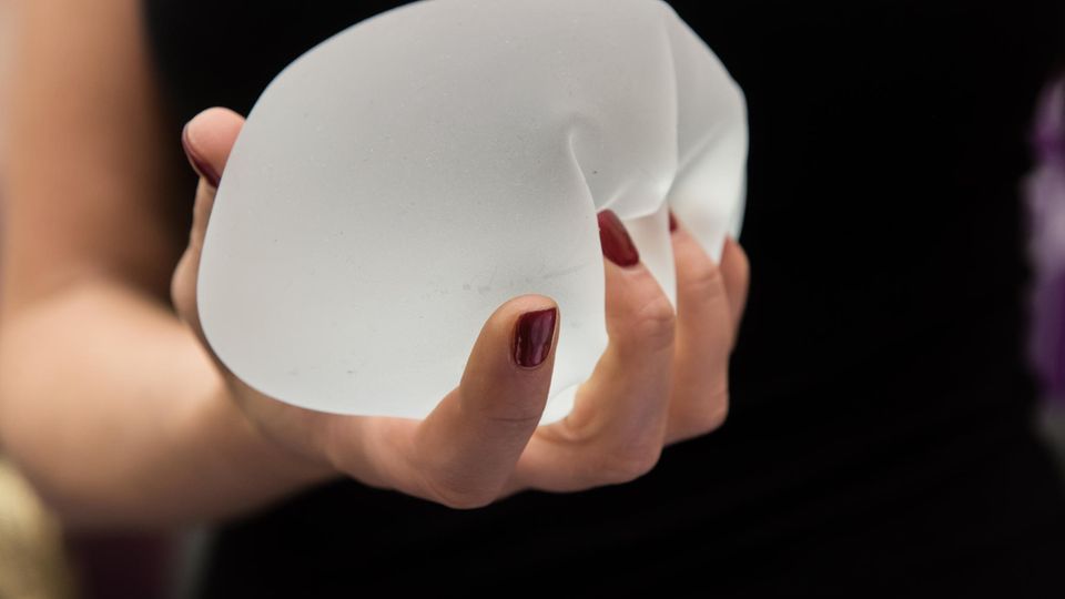 A woman with a breast implant.  Diseases after surgery should now be better researched.