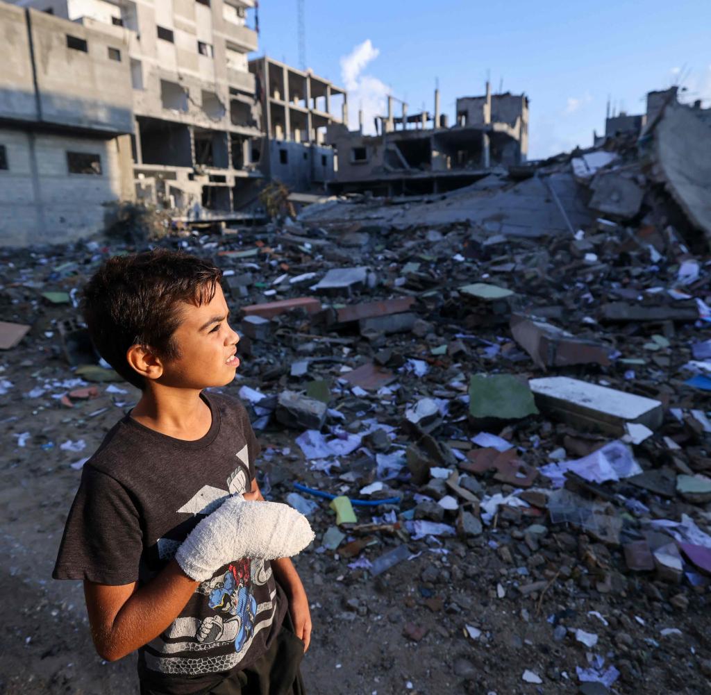 Mohamed, 12, from Gaza, now near the Rafah border crossing, he is wounded