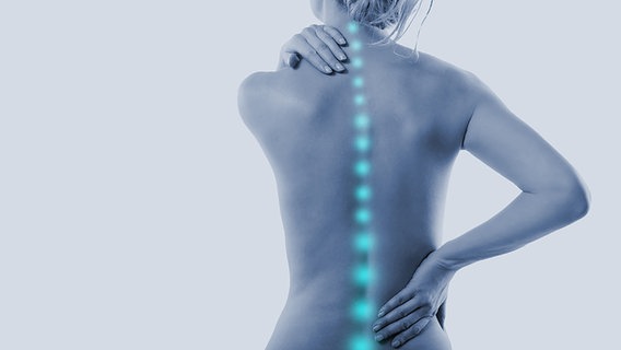 A woman grabs her neck and back, her spine indicated as a blue line to indicate pain.  © fotolia Photo: drubig-photo