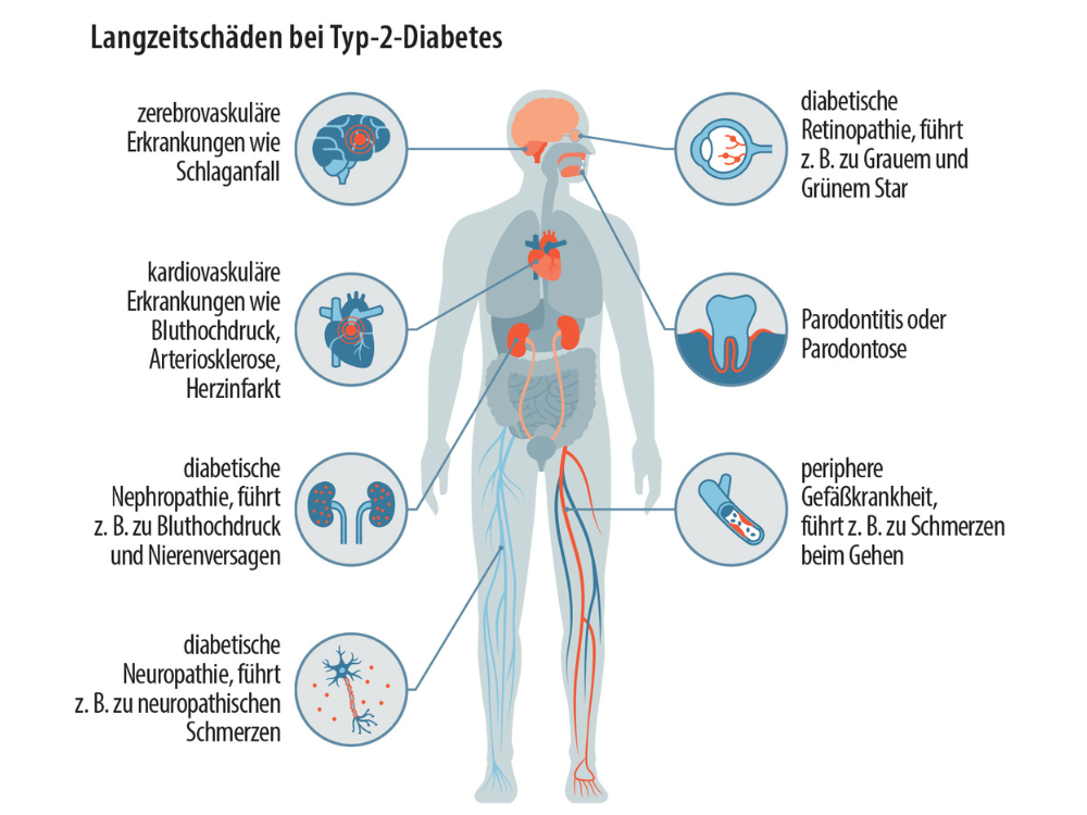 Grafik Langzeitschäden Diabetes
