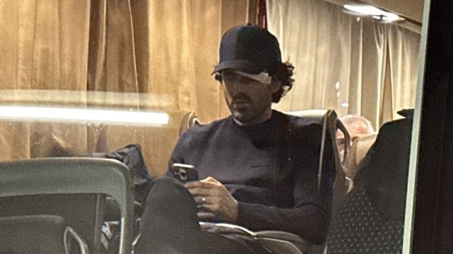 Attack on Lyon's team bus: Lyon coach Fabio Grosso is sitting on a bus again - this time freshly treated.