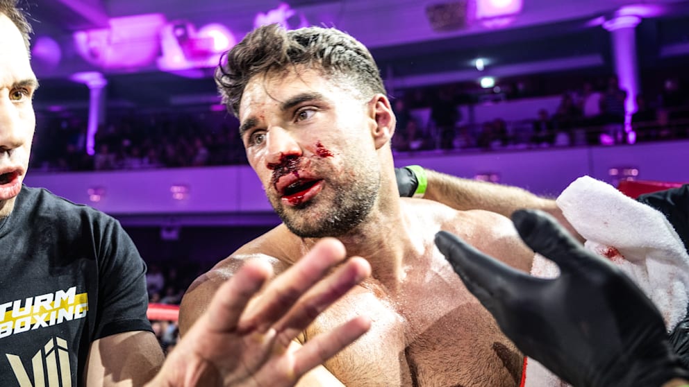 Ouch!  Aleks is already bleeding heavily in the second round, but he still risks a big lip with his accusations even after the fight
