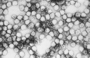 Microscopic image of yellow fever viruses