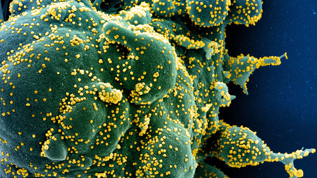 A cell infected with coronaviruses