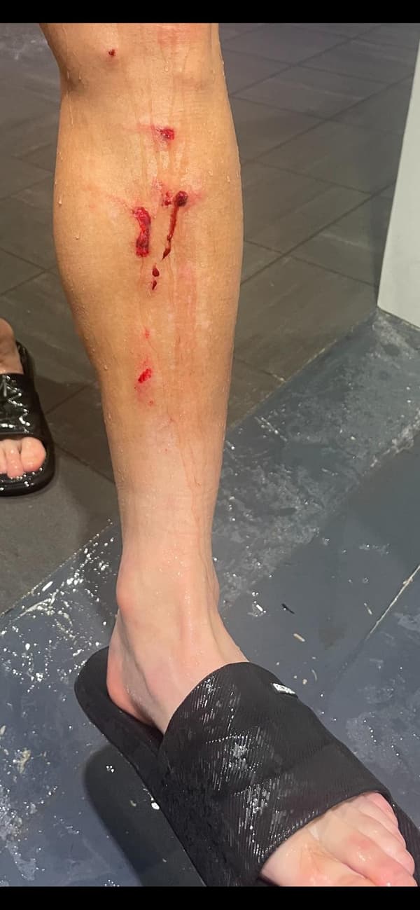 La jambe gauche de Takumi Minamino, victime du tacle de Dante lors de Nice-Monaco, 11 février 2024