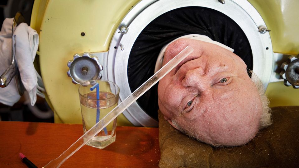 Paul Alexander has been living in an iron lung for decades because of polio