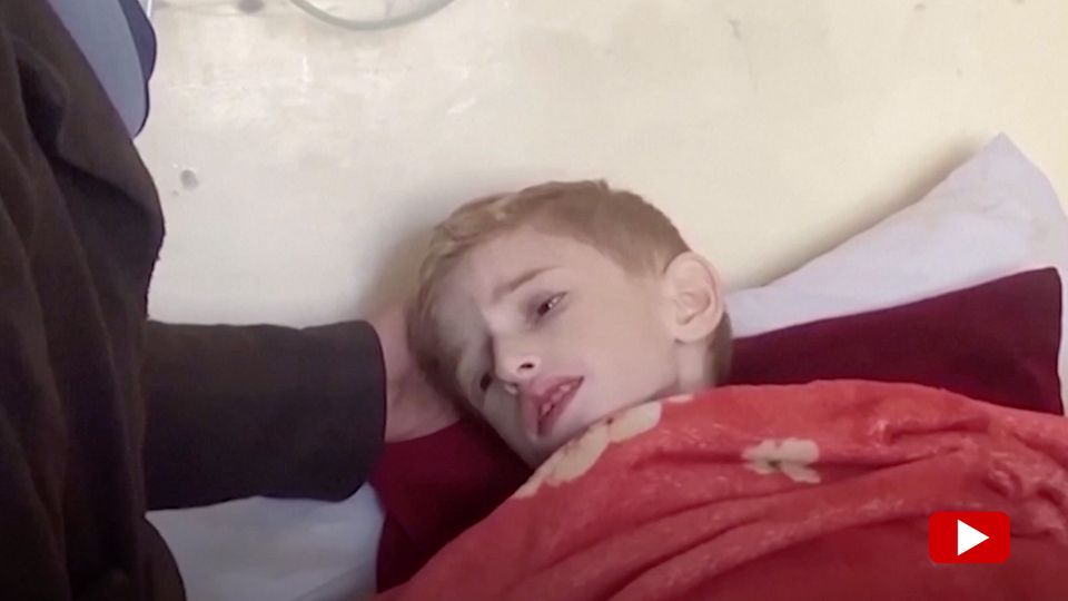 "The clock is ticking" – people like Fadi (6) are suffering from the famine in Gaza