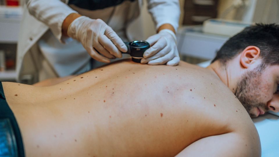 Skin cancer: These are excellent doctors in 2024